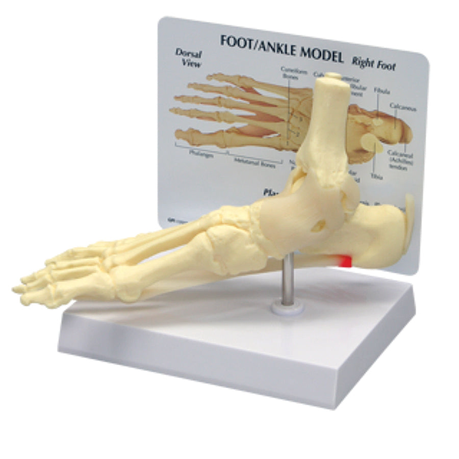 Foot/Ankle - Plantar Fasciitis
