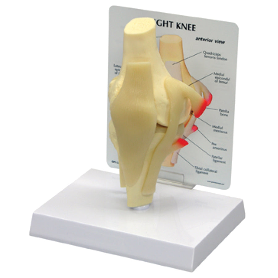 Basic Knee Model